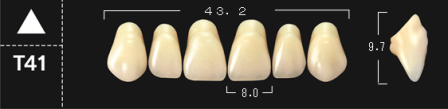 Crown NS A2*T41 boven 