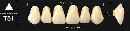Crown NS A2*T51 boven 