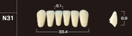 Crown NS A3*N31 onder 