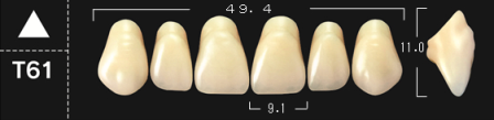 Crown NS A3*T61 boven 