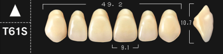 Crown NS A3*T61S boven 
