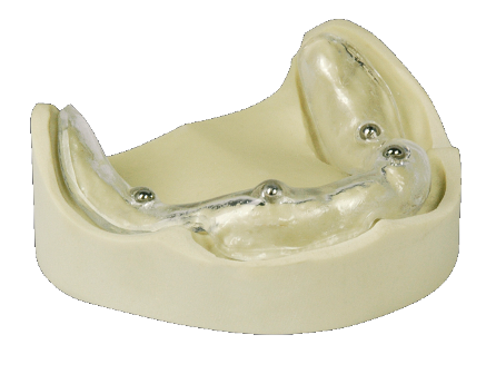 [1292812200] Drufoplast 3.0mm transparant D-4214 10st