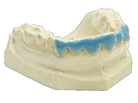 [1292841407] BioBleach hard 0.5mm x 120mm transparant D-420015 25st