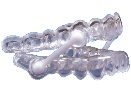 [1293626577] Silensor verbindingsdelen 10st 596000 (Let op, vervanger voor het oude artikel)