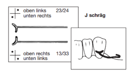 [1527821714] J-klammers 0.9mm nr.1021/1 5xR+5xL schuin 
