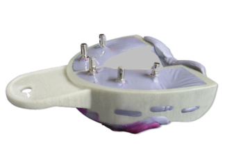 [9302020003] Miratray nr.101252 medium boven 6st